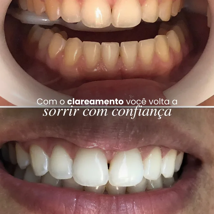 Publicação 3 do Instagram da Implanto Clínica Odontológica